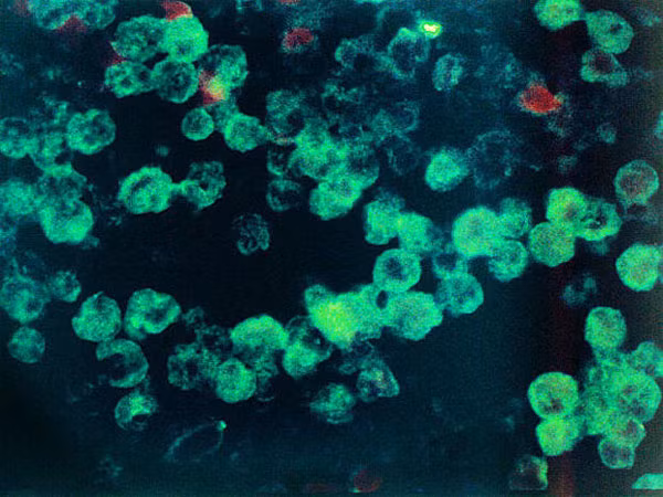 Trùng amip, một trong những loài vi khuẩn gây kinh hoàng nhất mọi thời đại. Có tên khoa học Naegleria fowleri, sinh sống ở các vùng nước ấm, sạch nhưng lại là loài trùng ăn não người ghê rợn. Amip xâm nhập vào cơ thể qua đường hô hấp, qua màng xoang vào hành khứu giác.