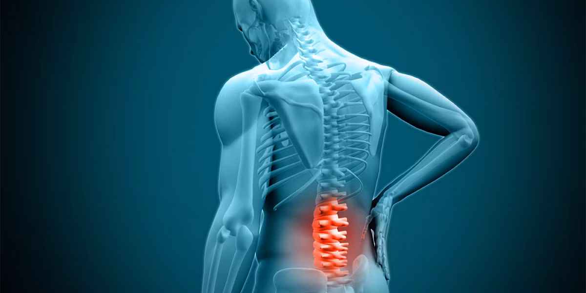 Nguyên nhân gây đau thần kinh tọa do thoát vị đĩa đệm: Hai động tác kéo giãn này giúp tạo khoảng cách giữa các đĩa đệm phình ra ở cột sống, lấy áp lực ra khỏi dây thần kinh tọa. Ảnh: Internet