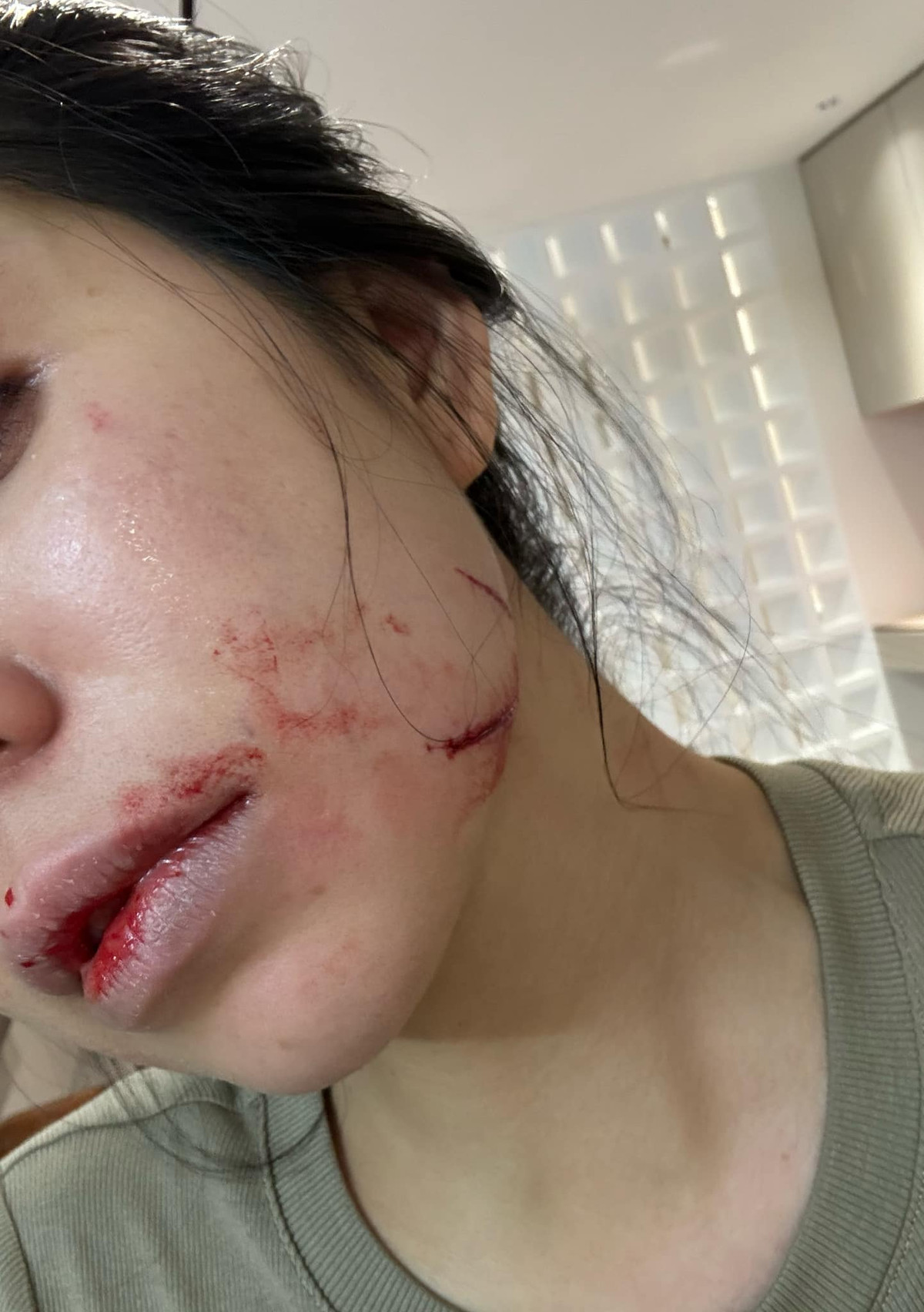 Vào khoảng tháng 8, cô nàng từng khiến người theo dõi lo lắng khi công khai hình ảnh bị bạo hành bởi chồng cũ.