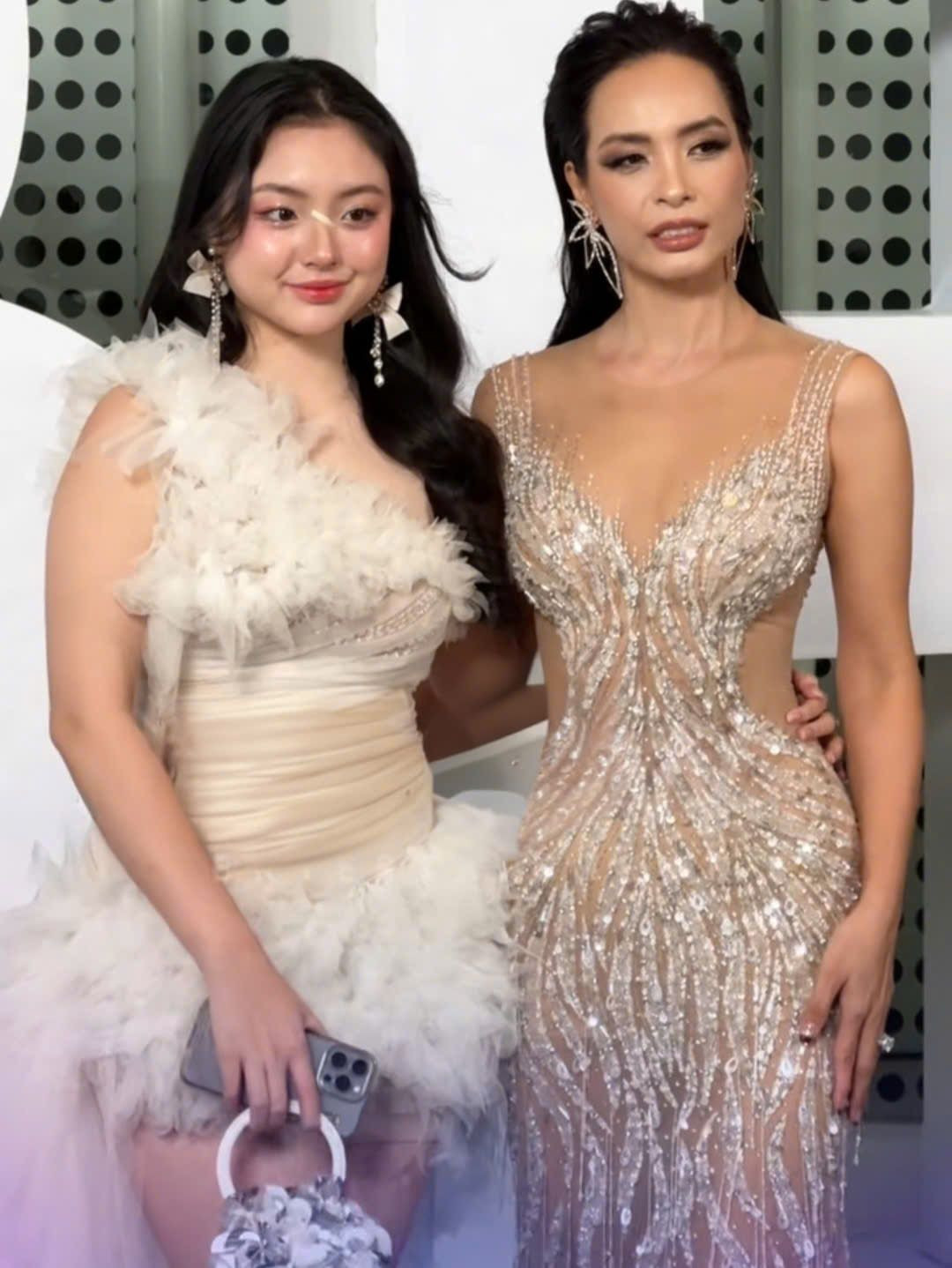 Ở sống mũi cô nàng phài dùng băng dán cá nhân để che đi vết thương do chơi cầu lông bị vợt đập trúng, tuy nhiên không hề ảnh hưởng đến nhan sắc tổng thể.