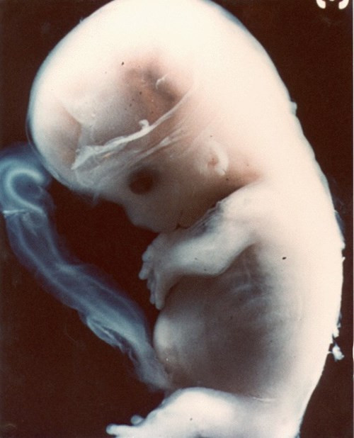 Trong ảnh gửi người ngoài hành tinh có hình bào thai, hình cơ quan sinh dục nam và nữ, tinh trùng tiếp cận trứng trong quá trình thụ tinh, sinh con, người mẹ cho con bú, bố bế con, ảnh gia đình.