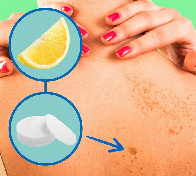 Bat mi tuyet chieu loai bo cac dom tan nhang lam tam tren da-Hinh-3