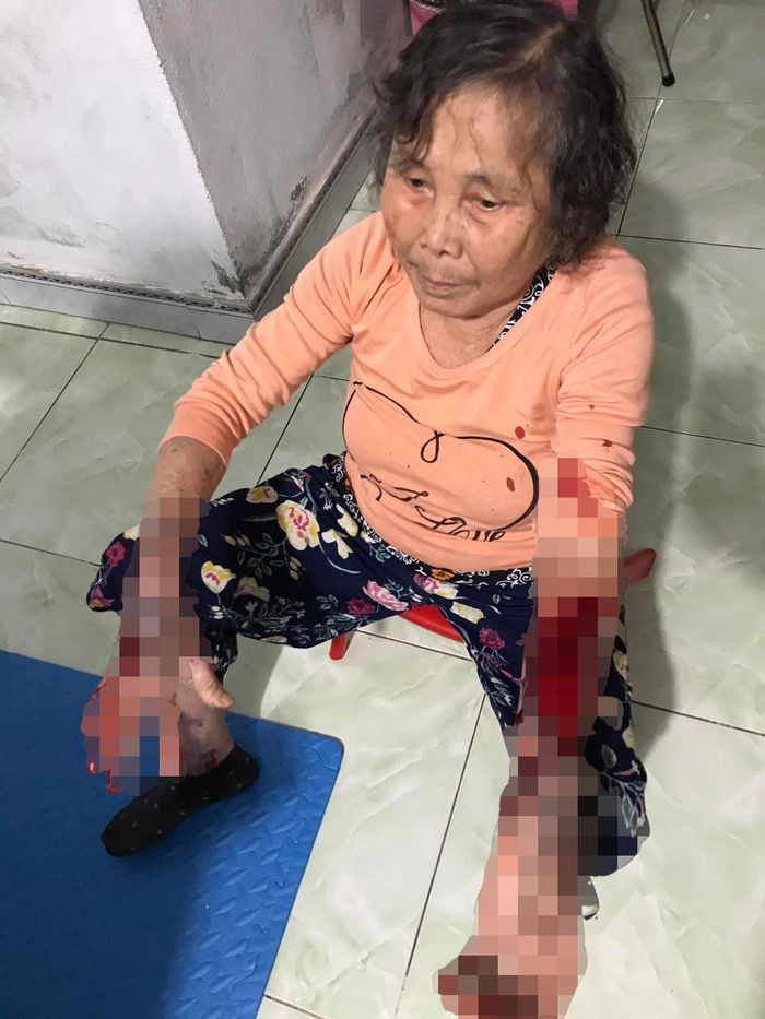  Nhắc hàng xóm mở nhạc lớn, cụ bà 83 tuổi bị đánh nhập viện: Sau khi nhắc hàng xóm giảm âm lượng vì mở nhạc lớn, bà Ngô Thị Hảo (40 tuổi) cùng mẹ là Nguyễn Thị Hội (83 tuổi, trú An Tiến, An Lão, Hải Phòng) bị Đạt (41 tuổi) hành hung. Hậu quả, bà Hội phải nhập viện cấp cứu. 