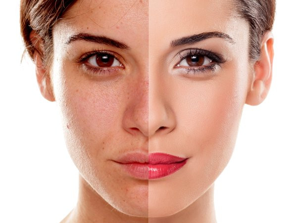  8. Giúp làm mờ tăng sắc số da: Cả mật ong và dầu dừa đều có đặc tính làm lành và làm mềm da giúp hồi phục, tái tạo và làm sáng da để loại bỏ sắc tố da. Cách thực hiện: Trộn 1 thìa cà phê mật ong và 1 thìa dầu dừa vào trong bát. Làm ướt da mặt rồi thoa hỗn hợp mật ong lên mặt. Mát-xa da mặt nhẹ nhàng trong vài phút. Rửa sạch hỗn hợp. Áp dụng phương pháp này đến khi thấy rõ kết quả.