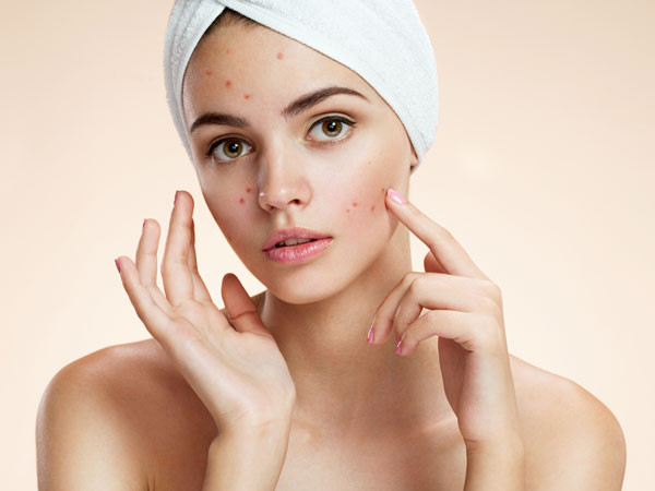  4. Trị mụn trứng cá và mụn nhọt: Với các đặc tính kháng khuẩn, mật ong làm hạn chế sự phát triển của vi khuẩn gây mụn trứng cá. Ngoài ra, các đặc tính chống viêm của mật ong làm giảm đau và khó chịu do mụn trứng cá gây ra. Cách thực hiện: Rửa mặt bằng sữa rửa mặt dịu nhẹ và nước ấm. Để da khô hoàn toàn rồi thoa một lớp mật ong đều lên mặt và cổ. Để trong 15-20 phút rồi rửa sạch. Thực hiện mỗi ngày đến khi mụn trứng cá bớt đi.