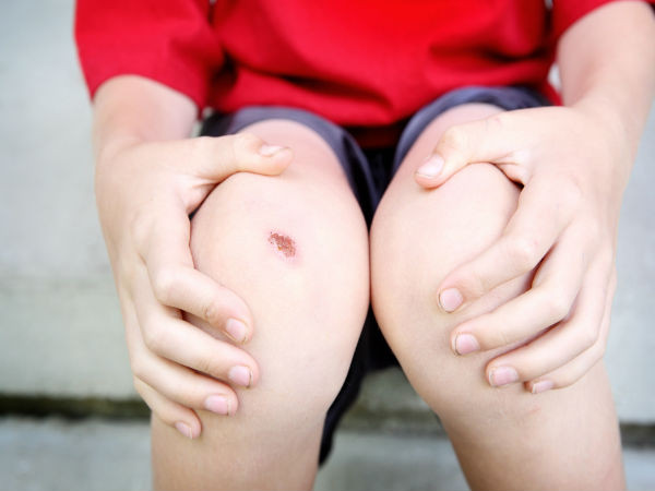  7. Làm lành các vết thương: Với các đặc tính chống viêm và làm lành vết thương nên mật ong giúp đẩy nhanh quá trình làm lành vết thương và là giải pháp hoàn hảo để điều trị các vết đứt và vết bỏng nhỏ. Cách thực hiện: Rửa tay kỹ rồi để khô. Thoa mật ong lên vết thương rồi đặt một miếng băng gạc sạch, khô lên phía trên mật ong. Sau đó, thay gạc khi cần. Sử dụng phương pháp này đến khi vết thương bắt đầu lành.