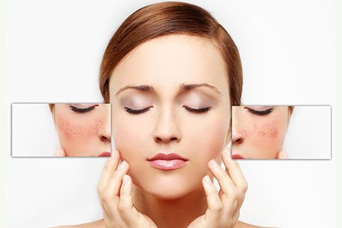 Nhiều sản phẩm chúng ta sử dụng hàng ngày có chứa axit. Trên thực tế, xà phòng và sữa rửa mặt mà chúng ta sử dụng có chứa axit cũng như giúp chống nhiễm trùng. Nhưng, khi bạn có một làn da nhạy cảm, bạn cần cẩn thận. Ảnh: verygirlie.