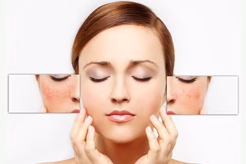 Nhiều sản phẩm chúng ta sử dụng hàng ngày có chứa axit. Trên thực tế, xà phòng và sữa rửa mặt mà chúng ta sử dụng có chứa axit cũng như giúp chống nhiễm trùng. Nhưng, khi bạn có một làn da nhạy cảm, bạn cần cẩn thận. Ảnh: verygirlie.