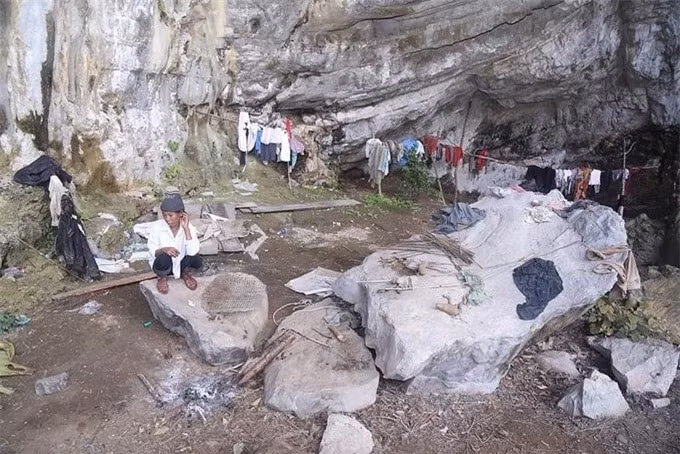 Bo toc Viet Nam bi an nhat the gioi, dung phep thuat chua benh-Hinh-3