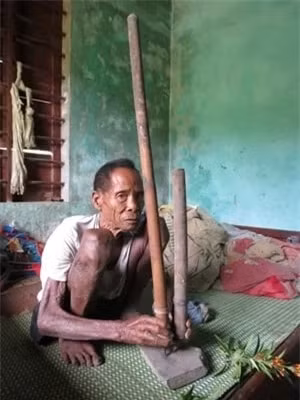 Bo toc Viet Nam bi an nhat the gioi, dung phep thuat chua benh-Hinh-5