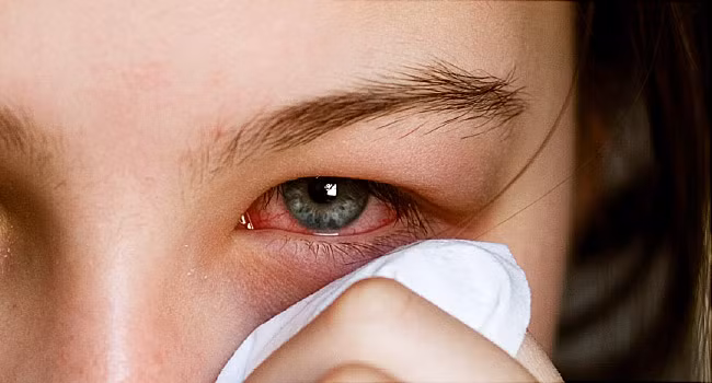 Diem danh 5 benh mua thu thuong gap va cach phong tranh-Hinh-4