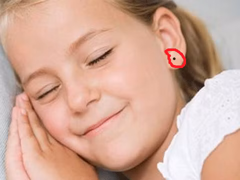  Nốt ruồi ở tai: Tai tượng trưng cho tài vận và sức khỏe. Người có nốt ruồi ở phần trên của tai là người bẩm sinh thông minh, lanh lợi, còn người có nốt ruồi ở phần dưới tai là người có tài vận vô cùng tốt đẹp, người có nốt ruồi ở trong tai lại là người trường thọ. Ảnh: sohu.com. 