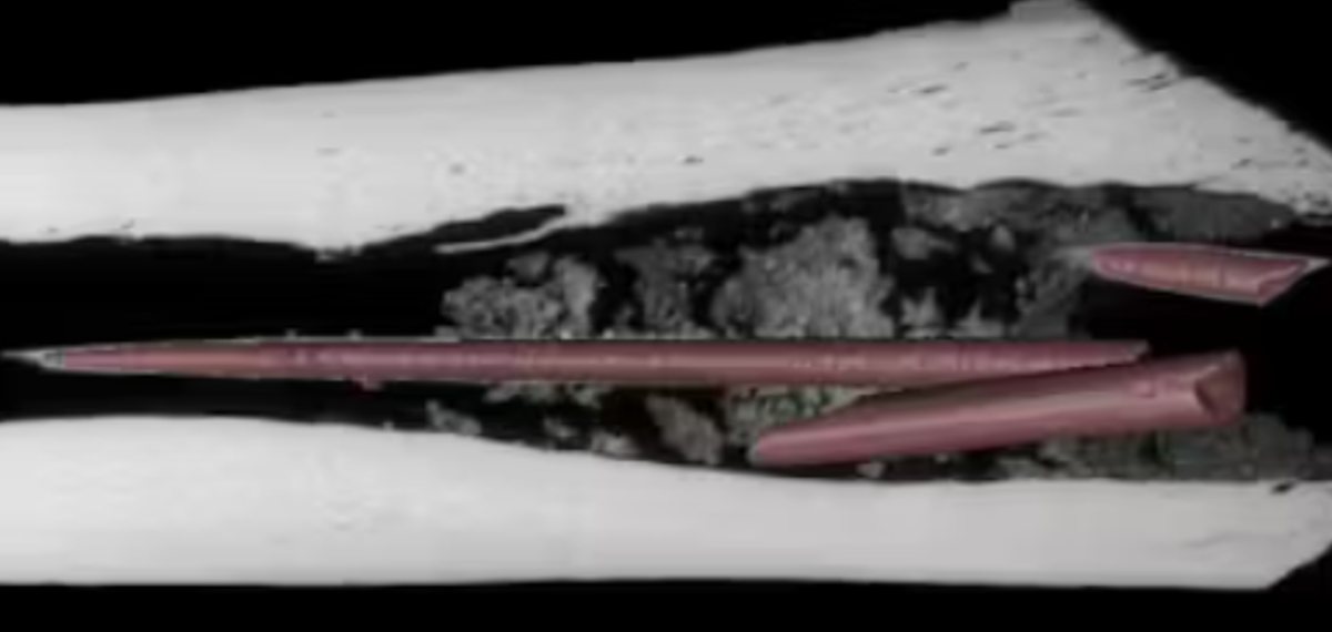 Các lần quét vi mô CT, cùng với nhiều kỹ thuật thăm dò khảo cổ tiên tiến, đã tiết lộ khoang tủy khúc xương này chứa đầy trầm tích các chất hóa học kỳ lạ. Thế nên, các xét nghiệm thăm dò hóa học đã được tiến hành ngay sau đó. Ảnh: @Dr Aliénor Duhamel.