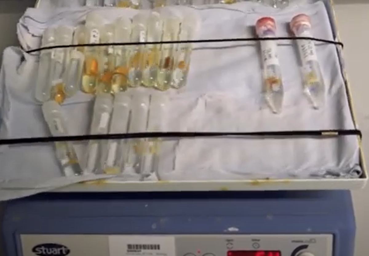 Không rõ tại sao thị trấn Herculaneum lại có chế độ ăn dựa trên giới tính. Các chuyên gia nghi ngờ, có thể là do đàn ông nắm giữ những vị trí đặc quyền trong xã hội, do đó ăn những mặt hàng đắt tiền hơn như hải sản tươi. Ảnh: @Brighton &amp; Hove Museums.