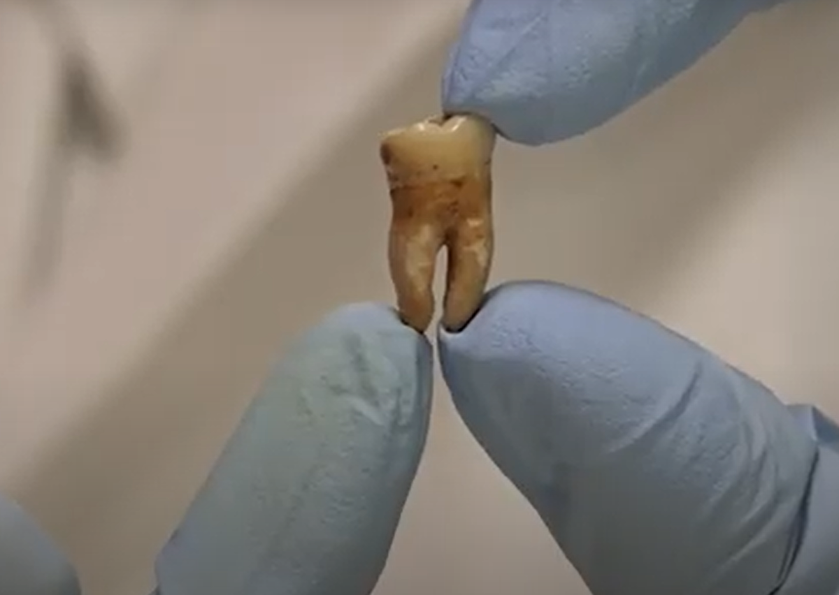 Ở thị trấn La Mã này, họ phát hiện đàn ông và phụ nữ có chế độ ăn khác nhau. Đàn ông tiêu thụ nhiều ngũ cốc và hải sản, cá tươi hơn 50% so với phụ nữ. Phụ nữ ăn nhiều sữa, trứng, trái cây và rau quả địa phương, thịt từ động vật trên cạn. Ảnh: @Brighton &amp; Hove Museums.