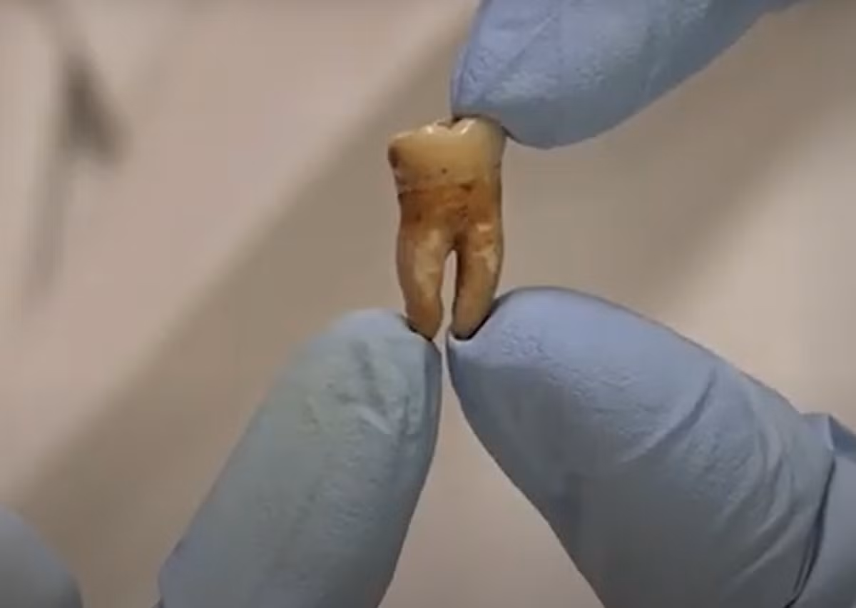 Ở thị trấn La Mã này, họ phát hiện đàn ông và phụ nữ có chế độ ăn khác nhau. Đàn ông tiêu thụ nhiều ngũ cốc và hải sản, cá tươi hơn 50% so với phụ nữ. Phụ nữ ăn nhiều sữa, trứng, trái cây và rau quả địa phương, thịt từ động vật trên cạn. Ảnh: @Brighton &amp; Hove Museums.