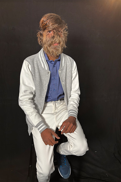 Lalit Patidar cho biết, đôi khi mọi người vẫn bảo anh nên cạo hết lông mặt. Đáp lại, Lalit Patidar nói rằng: "Quả thật, không có nhiều thứ để nói với mọi người về chủ đề này. Tôi muốn với họ rằng, tôi thích con người hiện tại của mình và không muốn thay đổi ngoại hình". Ảnh: @guinnessworldrecords. 