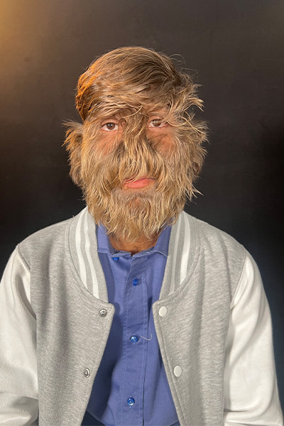 Cậu bé chia sẻ với Tổ chức Kỷ lục Guinness Thế giới rằng, những đứa bạn ở trường "rất sợ tôi khi tôi đến trường vào ngày đầu tiên. Nhưng khi họ bắt đầu làm quen và nói chuyện với tôi, họ đã hiểu rằng tôi không khác họ mấy, tôi chỉ trông khác biệt ở bên ngoài, nhưng bên trong thì không khác biệt". Ảnh: @guinnessworldrecords.