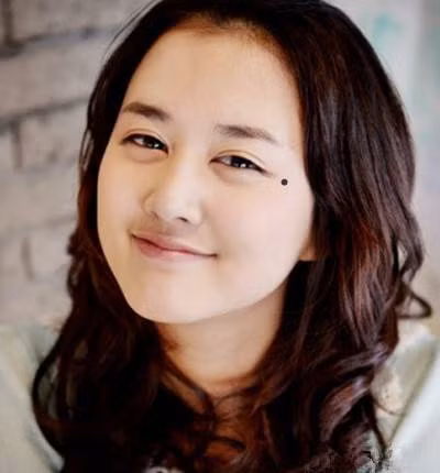 Trong tướng số học, gian môn được xem là cung hôn nhân, phía bên trái là tượng trưng cho người chồng. Nếu có nốt ruồi ở khu vực này sẽ ảnh hưởng xấu đến Phu Tinh, và thời gian khắc sẽ vào năm người phụ nữ 35 tuổi. Chính vì vậy nếu có nốt ruồi ở tả gian môn thì nhất định phải xóa bỏ, nếu không sẽ ảnh hưởng đến vận thế của bạn đời. Ảnh: image.baidu.com. 