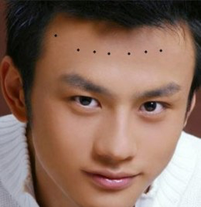 Người có bảy nốt ruồi đại quý trên trán chắc chắn là người có tướng đại phúc đại quý và đặc biệt có tướng đế vương. Ảnh: soha.vn.