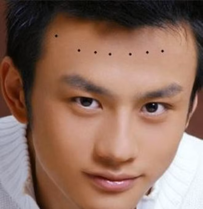 Người có bảy nốt ruồi đại quý trên trán chắc chắn là người có tướng đại phúc đại quý và đặc biệt có tướng đế vương. Ảnh: soha.vn.