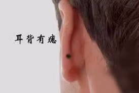  Nốt ruồi sau tai: Thông thường nốt ruồi mọc ở sau tai là tượng trưng là tài vận hưng vượng, hơn nữa lại giữ được tiền bạc. Ngoài ra, người sở hữu nốt ruồi ở vị trí này, vận quý nhân vô cùng vượng phát, luôn có quý nhân giúp đỡ khi gặp khó khăn,t rở ngại trong cuộc sống. Ảnh: xingzuo123.com.