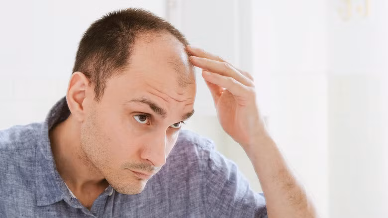 Có cách khác là trộn móng guốc động vật và bàn chân chó vụn, với nước ép quả chà là và để lại trên da đầu. Tuy nhiên, cả hai hỗn hợp trên đều không hiệu quả, và gây ra tình trạng phát ban da đầu, mùi hôi khó chịu. Ảnh: @Grunge.