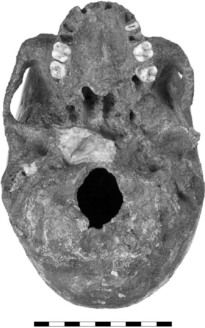 Hóa thạch Mladeč 1 được tìm thấy không có hàm và thiếu một số răng nên đầu tiên, các nhà nghiên cứu đã phải tiến hành ước lượng khuôn mặt và hoàn thiện hộp sọ để có thể tái tạo lại khuôn mặt. Ảnh: Researchgate.