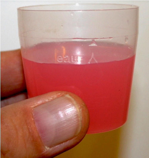 Sử dụng nước súc miệng sau đánh răng. Nước súc miệng cần thiết cho việc vệ sinh răng miệng song phải dùng đúng cách. Cụ thể, bạn nên sử dụng nước súc miệng sau khi ăn hoặc trước khi đánh răng. Súc miệng sau đánh răng khiến các thành phần trong nước súc miệng rửa sạch florua nồng độ cao, tạo florua nồng độ thấp thu hút vi khuẩn. Duy trì thói quen tưởng tốt này lâu ngày dễ dẫn đến sâu răng. (Ảnh: Brightside)