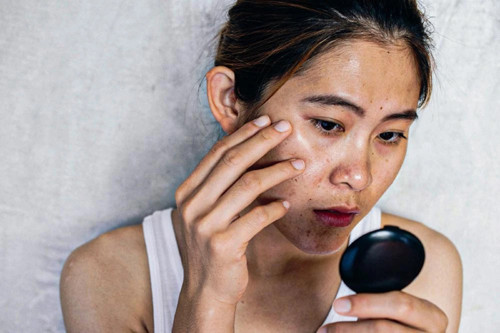 Y học hiện đại cũng ghi nhận, mắc các bệnh gan mãn tính như viêm gan mãn tính, xơ gan. Nếu không điều trị, các bệnh mãn tính hình thành xơ gan, ung thư gan. Do đó, nếu da bỗng chuyển đen sạm, cơ thể mắc các bệnh mãn tính lâu năm thì nên kiểm tra gan thường xuyên để phát hiện sớm các tổn thương ác tính.