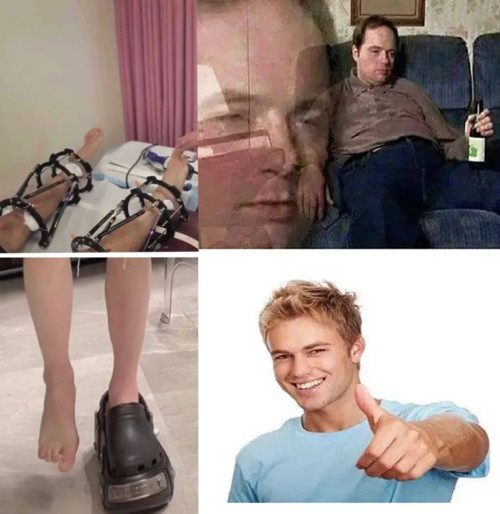 Sự tiện dụng của dép đế dày kiểu này hấp dẫn đến mức một lập trình viên ở Thung lũng silicon – người từng chi hơn 100.000 đô la Mỹ để phẫu thuật kéo dài chân đã thốt lên: Nếu biết nó sớm, tôi không phẫu thuật mà mua cả xe tải đầy dép, thay đổi trong cả năm.