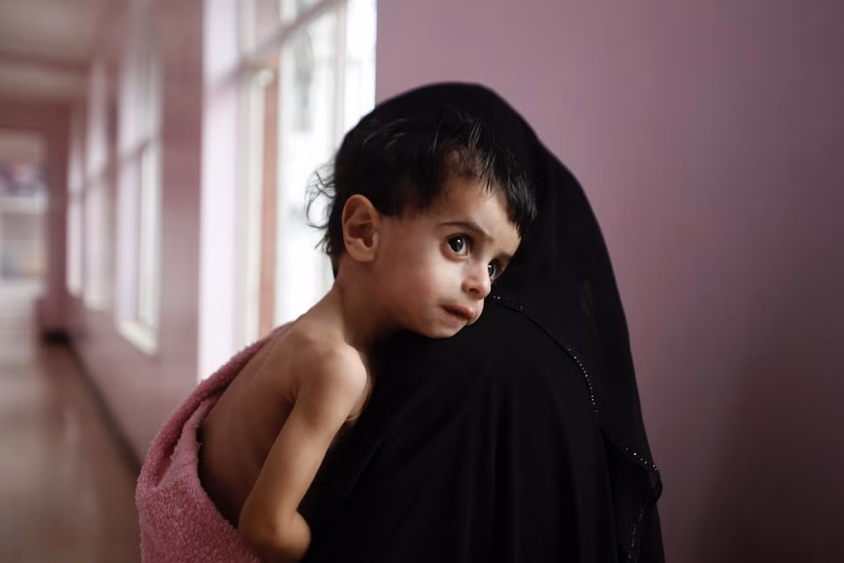 “Nếu không có sự can thiệp trực tiếp và ngay lập tức, chúng ta có thể phải hứng chịu một thảm họa nhân đạo”, Ibrahim cảnh báo.