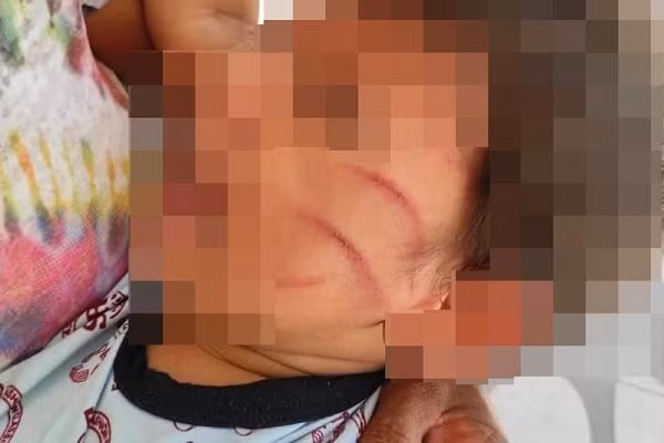 Be 2 tuoi bi danh tan nhan vi lam hu vo boc dien thoai