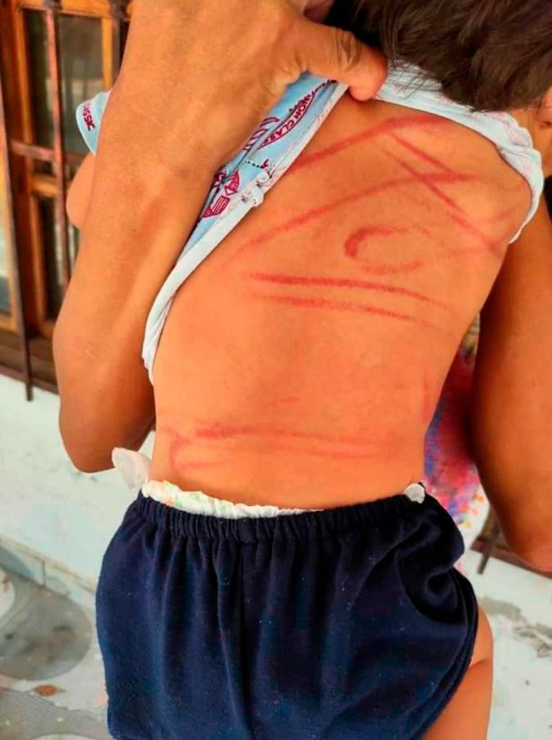 Be 2 tuoi bi danh tan nhan vi lam hu vo boc dien thoai-Hinh-2