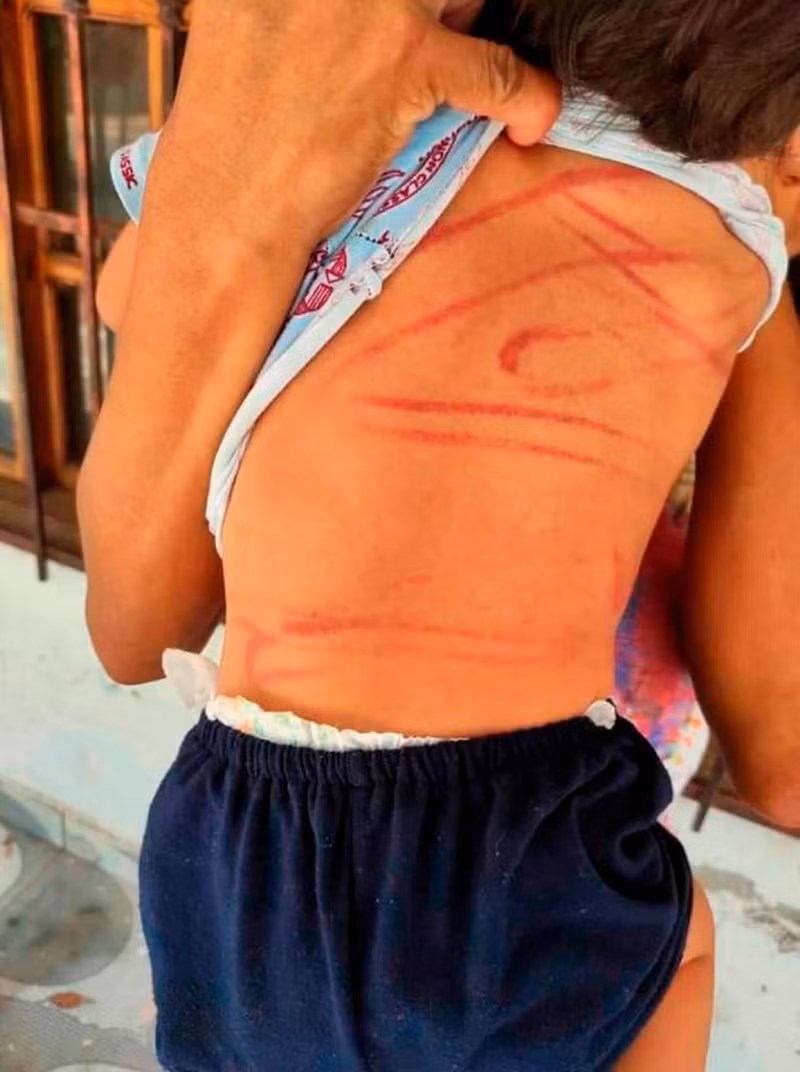 Be 2 tuoi bi danh tan nhan vi lam hu vo boc dien thoai-Hinh-2