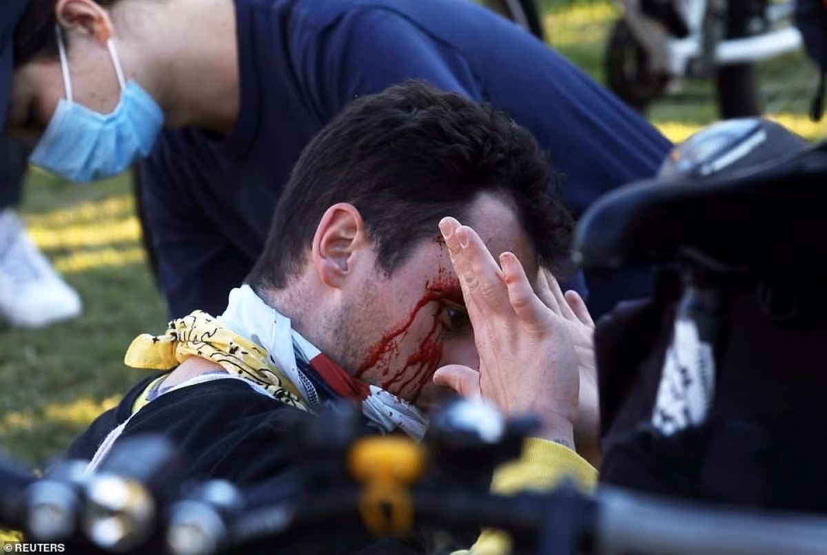 Bao luc bung phat trong bieu tinh giua phe ung ho va chong ong Trump-Hinh-17