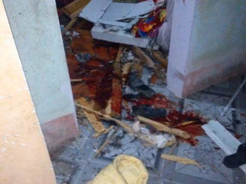 Ong om min tu sat, nhieu nguoi trong gia dinh thuong vong