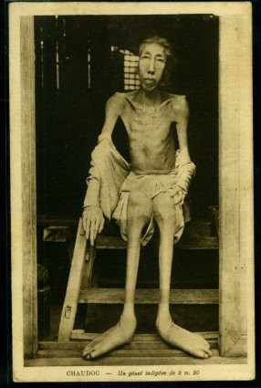 Một người "khổng lồ" ở Châu Đốc, có chiều cao 2,2 mét.