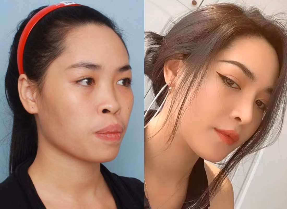 Từ khi sinh ra, Thanh Quỳnh đã từng tự ti với những khiếm khuyết trên gương mặt. Những khiếm khuyết đó đã khiến cho cô gái này rất tự ti và từng bị bố mẹ bạn trai phản đối vì ngoại hình không tương xứng.