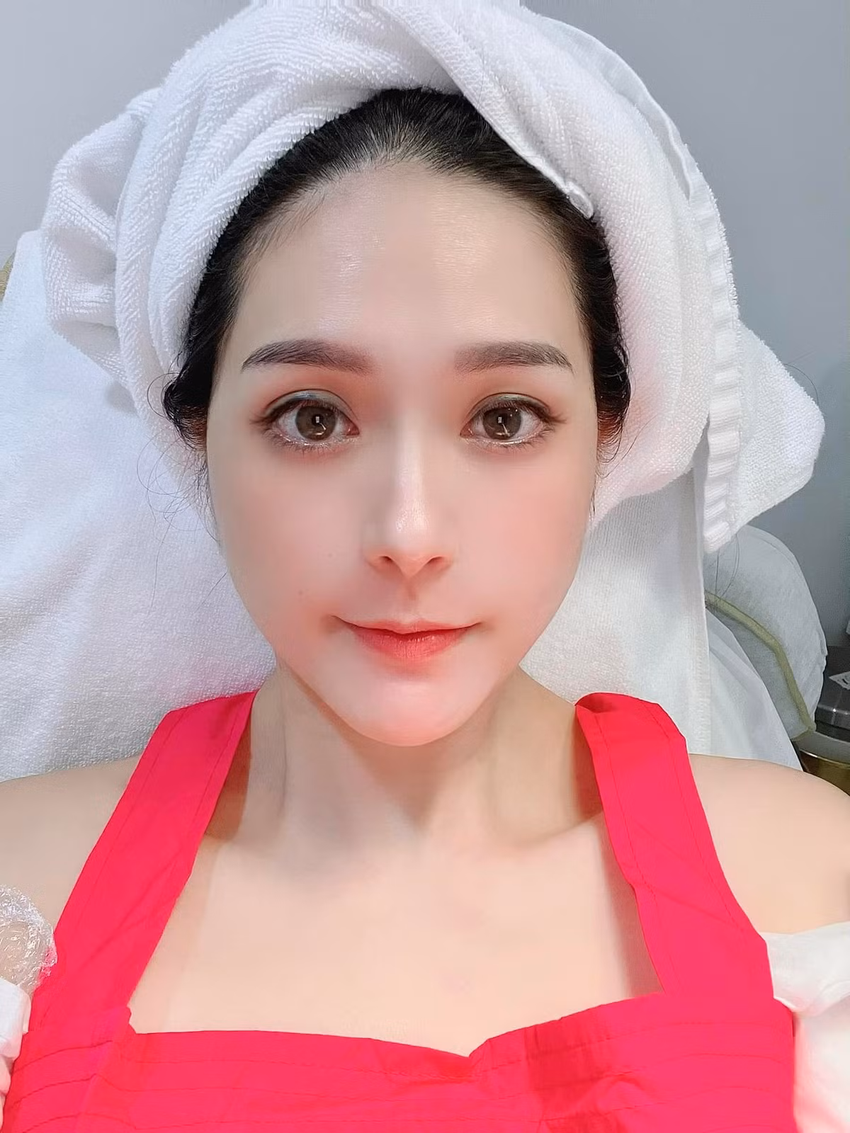 Ngoài hình ảnh gương mặt đã được tân trang xinh đẹp, Đoàn Di Băng còn khiến nhiều người không khỏi "hết hồn" với bức hình gương mặt chi chít mụn.