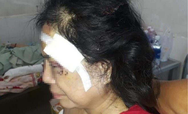 Chong danh vo cu da man o Phu Yen: Vi sao phu nu mai kho?