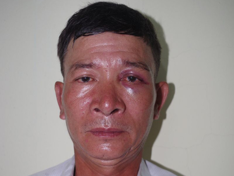 Thanh Hóa: Bắt kẻ vào nơi trông xe của bệnh viện để lừa đảo Thanh Hoa: Bat ke vao noi trong xe cua benh vien de lua dao