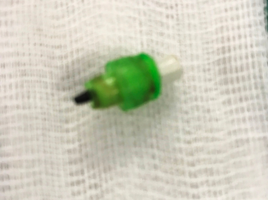 Thoi quen ngam but chi khien be gai 7 tuoi suyt mat mang