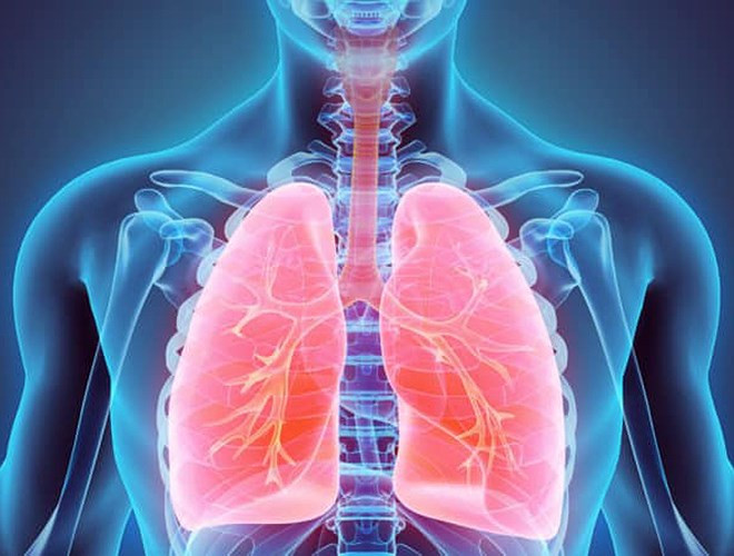  Viêm phổi có nhiều dạng khác nhau do có nhiều nguyên nhân gây bệnh khác nhau