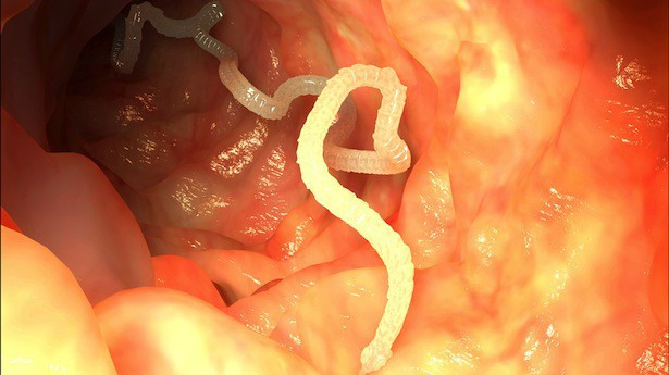 Sán dây: Theo Tổ chức Y tế Thế giới gần 1/3 các trường hợp bị bệnh động kinh là do bị nhiễm sán dây lợn, hàng năm đã có hơn 2000 người chết do mắc bệnh ấu trùng sán dây lợn ở não làm não bị nhiễm trùng nghiêm trọng. Sán dây trưởng thành phát triển rất nhanh trong ruột lợn, có thể ảnh hưởng đến não bộ của con người nếu không tuần thủ các nguyên tắc trong ăn uống. 