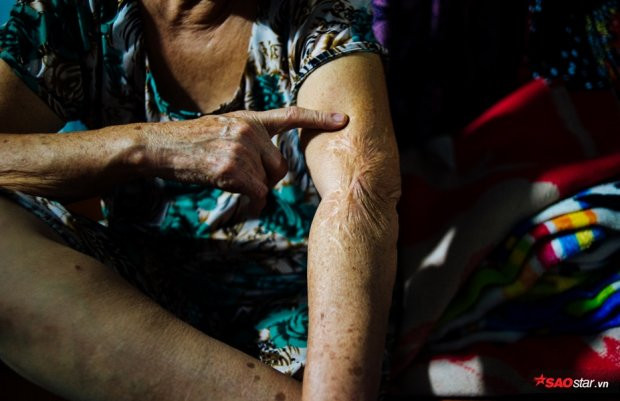 Mot lan yeu, nguyen lam tri ky ben co dao chuyen gioi o SG-Hinh-4