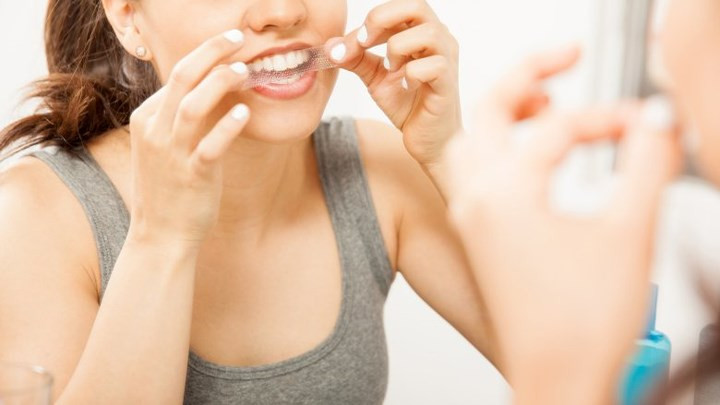 Răng ố vàng: Bất cứ khi nào bạn ăn hoặc uống những thứ có sắc tố sẫm màu như cà phê, trà, củ cải đường và rượu vang,... mà không đánh răng, chúng có thể làm cho răng của bạn bị ố vàng. Hút thuốc cũng có thể làm cho răng của bạn bị sẫm màu và trở nên ố vàng theo thời gian.