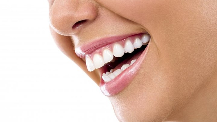 Viêm nướu: Viêm nướu là tình trạng viêm của nướu, gây ra bởi mảng bám hình thành do vệ sinh răng miệng kém, độc tố từ mảng bám này sẽ gây kích thích mô nướu. Viêm nướu nếu không chữa trị kịp thời sẽ phát triển thành viêm nha chu.