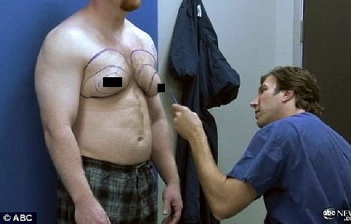 Bất thường trên da: Nếu thấy da vú có dấu hiệu không bình thường như bị lõm vào, hay tụt vào trong như lúm đồng tiền cũng phải lưu ý theo dõi và đi khám.