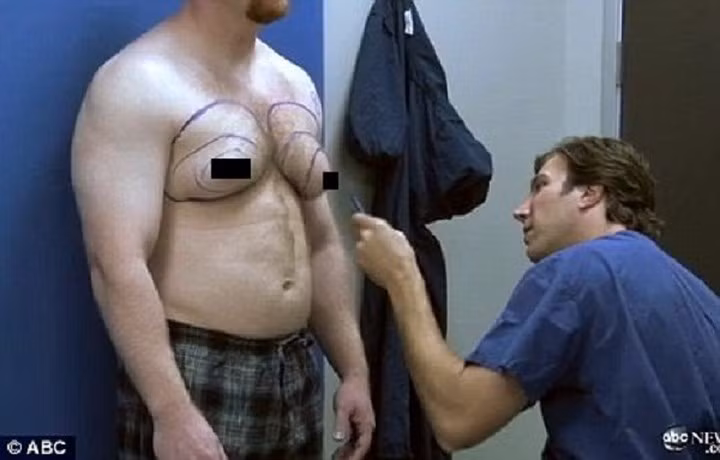 Bất thường trên da: Nếu thấy da vú có dấu hiệu không bình thường như bị lõm vào, hay tụt vào trong như lúm đồng tiền cũng phải lưu ý theo dõi và đi khám.